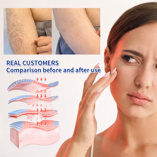 Ice Cool Equipo de belleza de alta calidad Depilación sin dolor Láser IPL