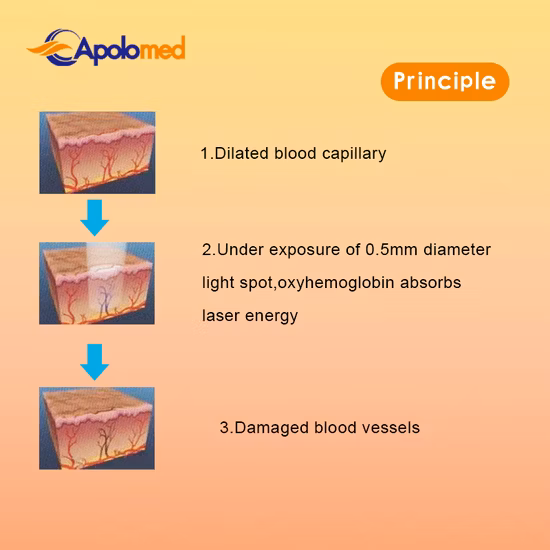 Equipo de belleza para la piel Mini dispositivo de depilación láser IPL con hielo de zafiro
